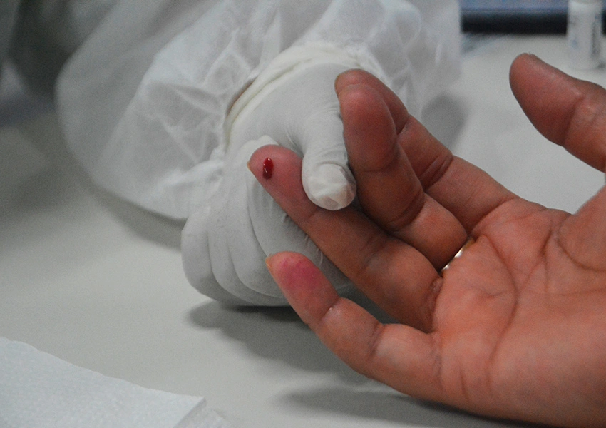 Hepatite A cresce 400% na Bahia em 2025 e atinge principalmente adultos jovens de 20 a 39 anos