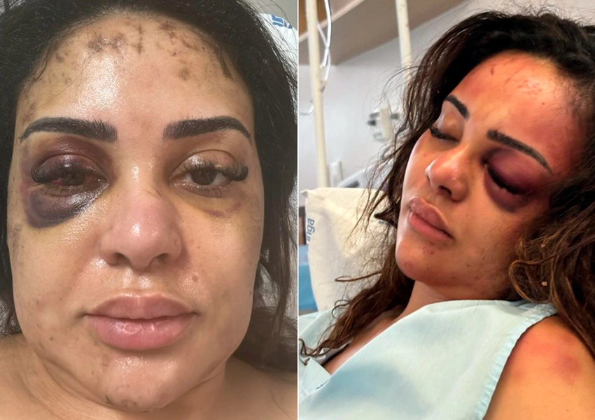 MP arquiva denúncia de médica que acusa ex-namorado de agressão