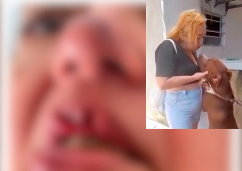 Mulher tem parte do lábio arrancado ao tentar dar 'selinho' em Pitbull