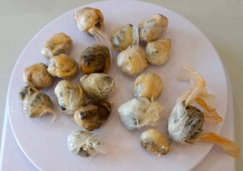 BodyScan flagra interno que engoliu 18 pacotes de maconha para entrar no presídio de Brumado