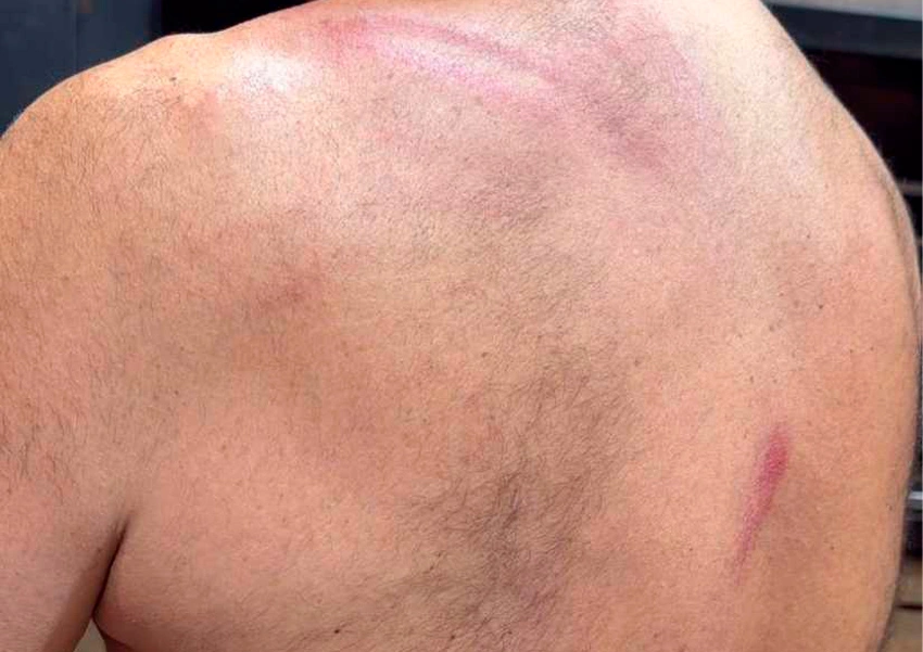 Empresário é espancado e ameaçado de morte por seguranças na festa “Melhor Feijão” em Vitória da Conquista