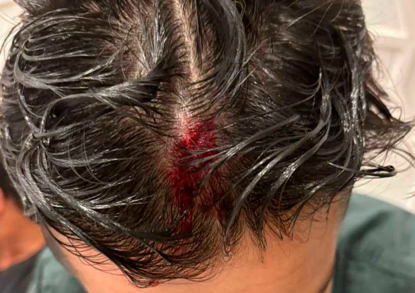 Empresário é espancado e ameaçado de morte por seguranças na festa “Melhor Feijão” em Vitória da Conquista