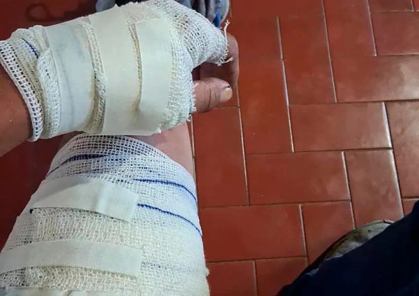 Entregador é atacado por pitbull durante entrega de lanche em Carinhanha