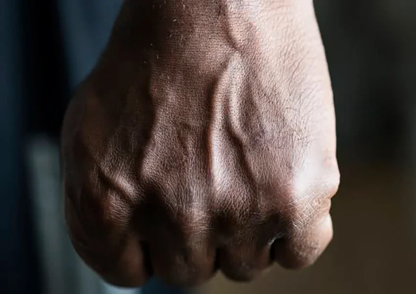 Pedreiro é espancado por quatro homens em bar após prestar serviços para um policial