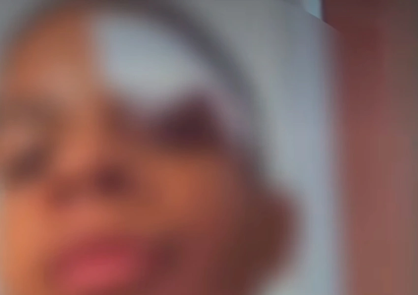 Criança de 11 anos leva 21 pontos após ser agredida por colegas em escola