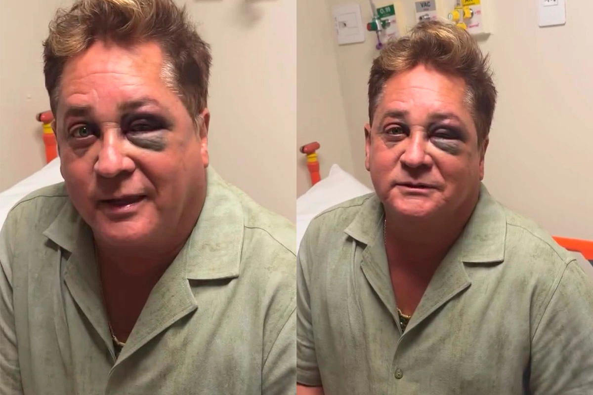 Cantor Leonardo bate o rosto em pescaria e aparece com olho roxo